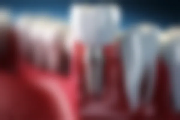 烤瓷牙的价格大概是多少？影响烤瓷牙费用的因素有哪些？