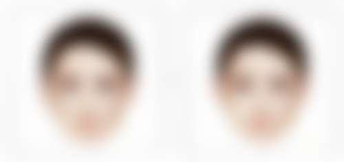 河源美斯嘉杨丽注射去除鱼尾纹的优势