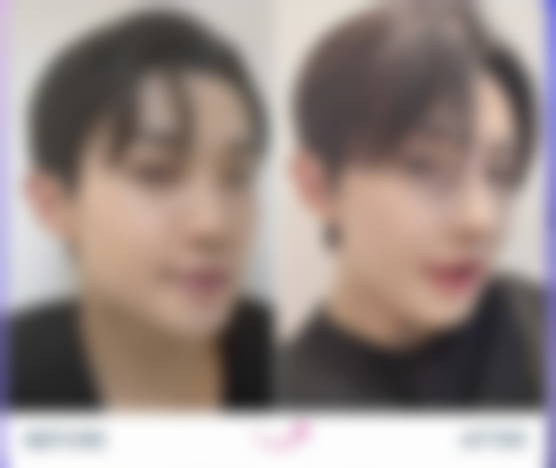 专精医生操作，保护注射成效与安心