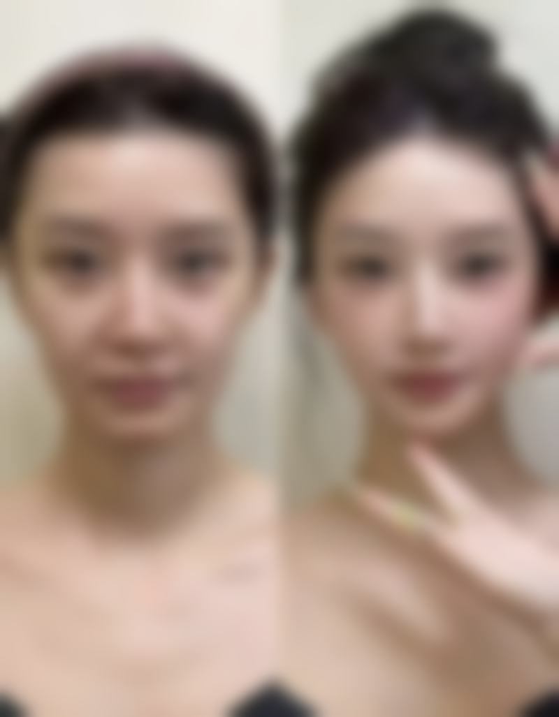 沈阳杏林整形外科医院是连锁医院吗？是的！技术优势显著很靠谱