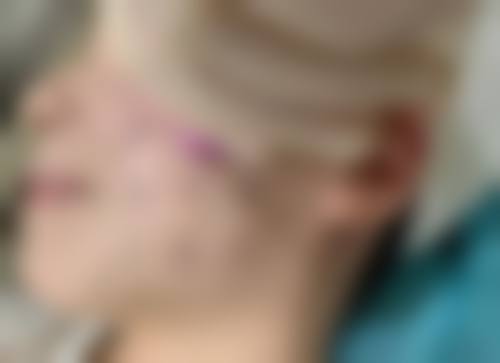 四、深圳卢迦诺医疗美容诊所特色项目