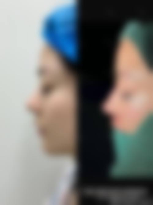 八、达州李双均整形医疗美容门诊部怎么预约？