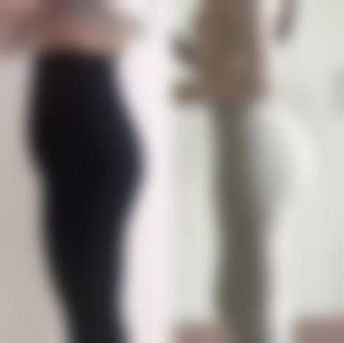 六、河南郑州大医整形医院口碑如何？