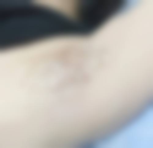 四、池州伊尚美医疗美容门诊部特色项目