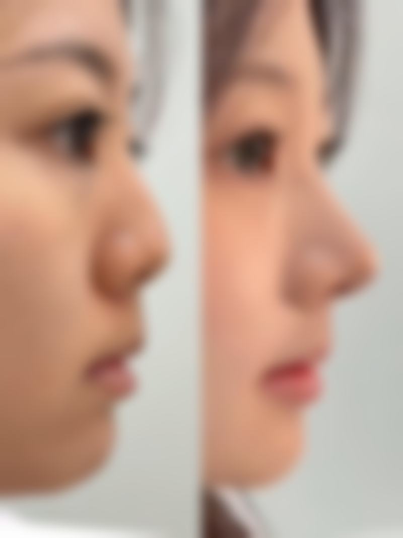 八、温州瓯海新桥林和敏医疗美容诊所怎么预约？