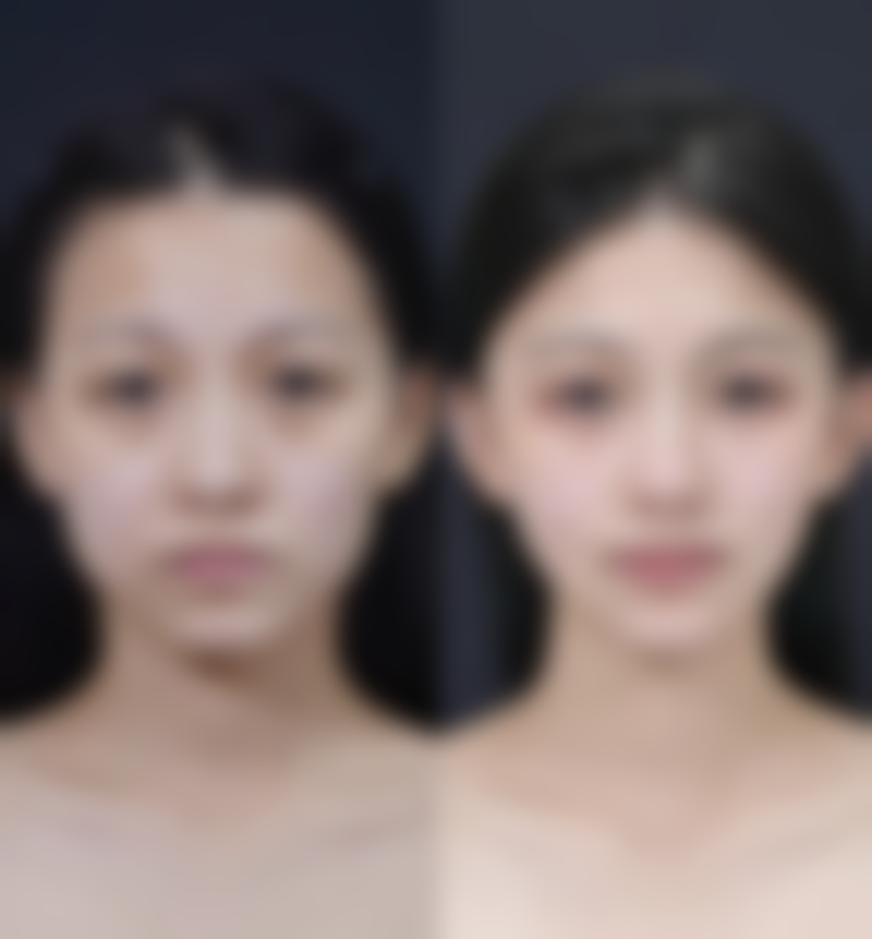 五、清远华美整形美容医院收费价格表