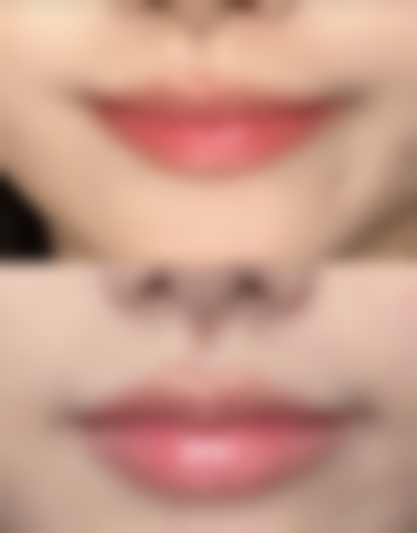 五、达州李双均整形医疗美容门诊部收费价格表