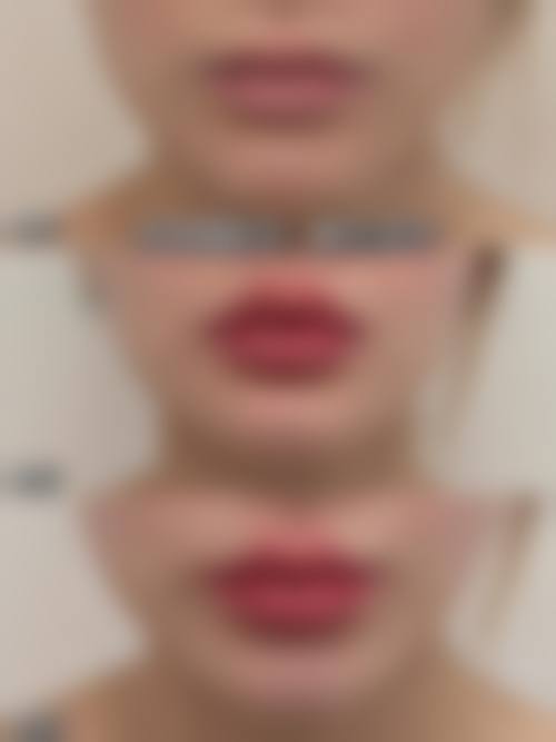 四、山东济南曹博士（原高涞德）医疗美容特色项目