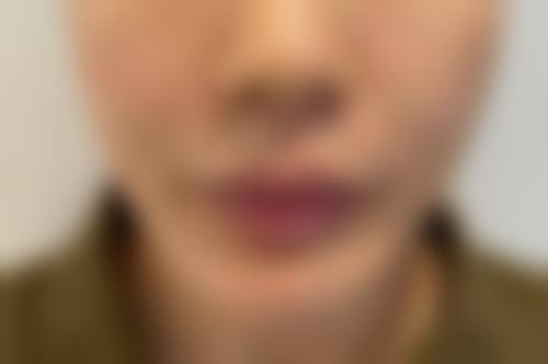 五、厦门华美整形美容医院收费价格表