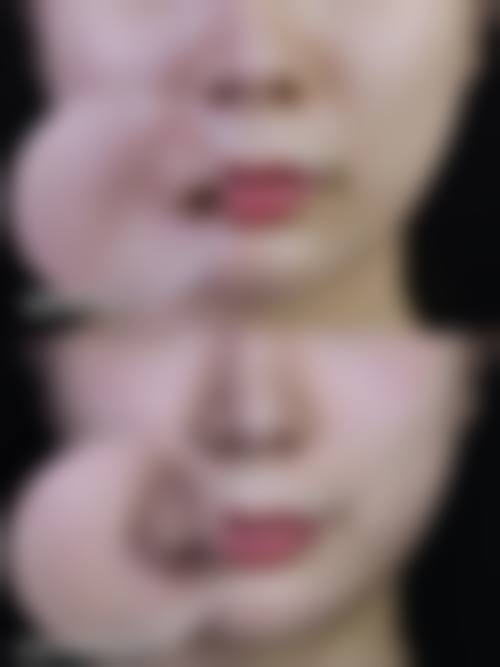 六、兰州斯美瑞医疗美容诊所口碑如何？