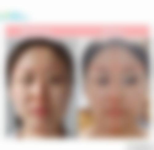 四、兰州斯美瑞医疗美容诊所特色项目