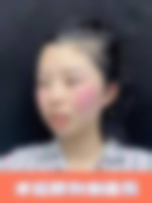 五、北京焕誉医疗整形医院收费价格表