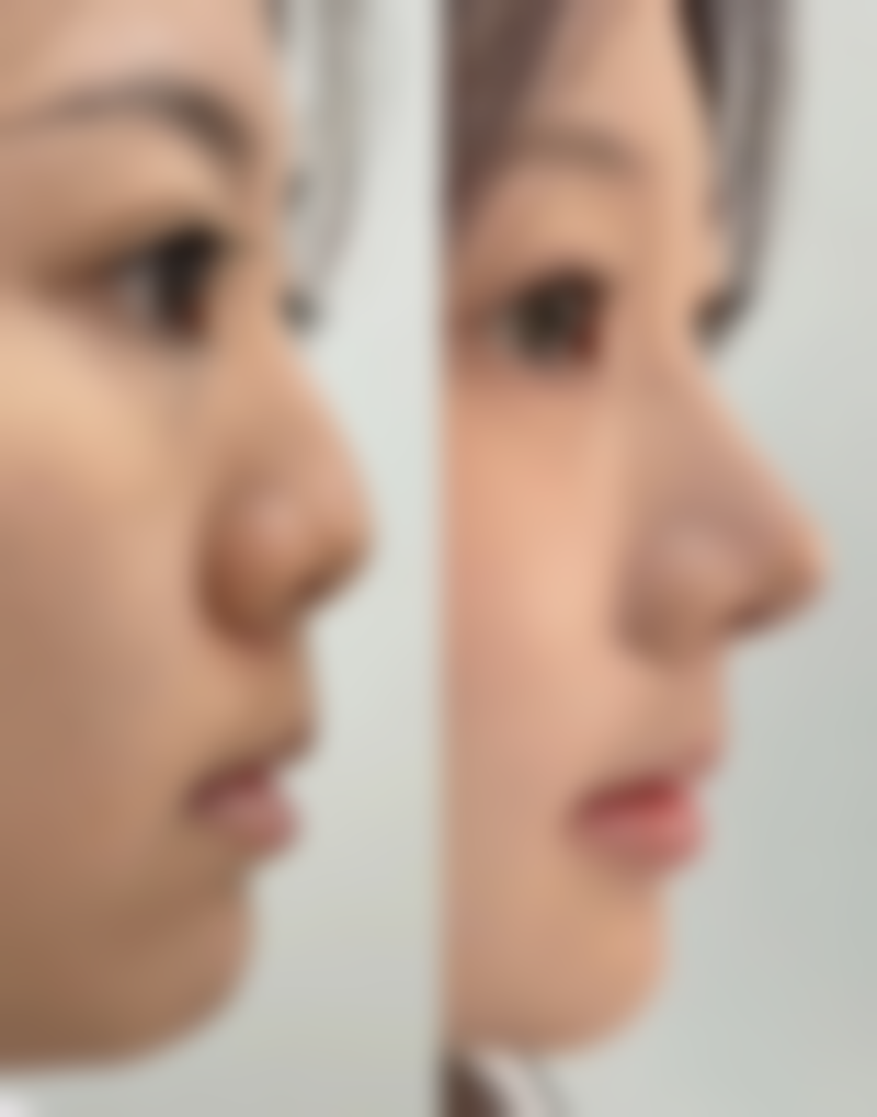 八、厦门华美整形美容医院怎么预约？