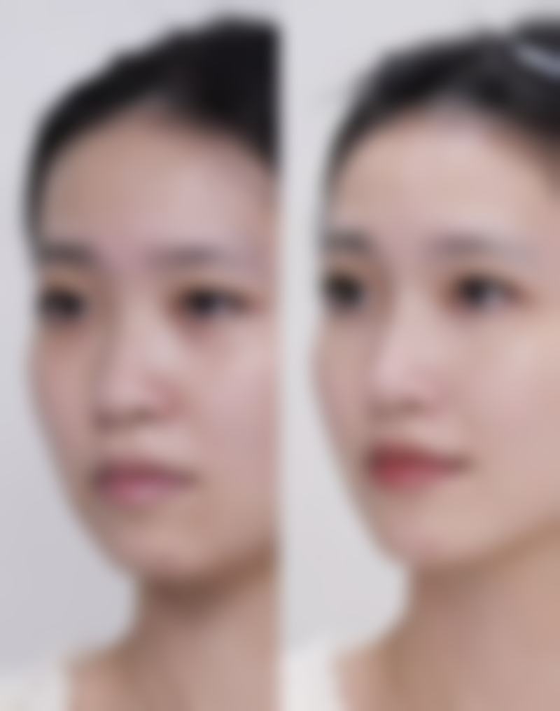 四、北京清木医疗美容整形医院特色项目