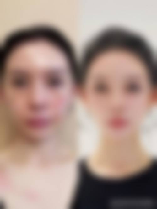 二、厦门大学附属翔安医院烧伤整形外科正规吗？来看医院资质信息