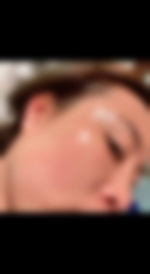 四、南充华美名媛医疗美容特色项目