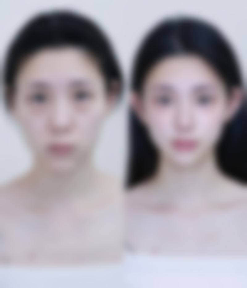 七、河北医 大二院整形美容赵雪莲医生怎么预约？