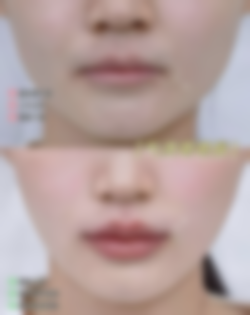 八、广州康华清医学美容医院怎么预约？