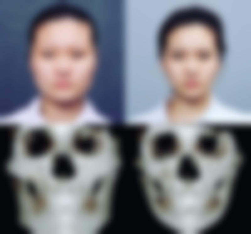 六、广西 南宁梦想整形医院口碑如何？