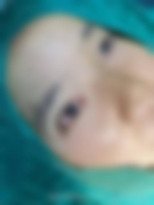 二、宿州惠尔美整形美容医院正规吗？来看医院资质信息