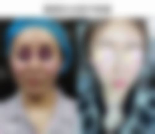 影响修复时间的因素