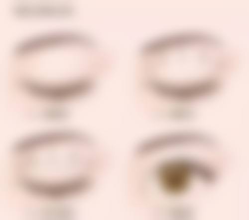 小阴唇缩小手术出血的危害