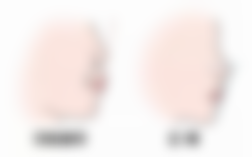 疤痕修复期是多久？受多种因素影响，不同情况修复期从数月到数年不等，一起来了解！ 