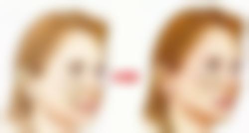 医美手段辅助修复