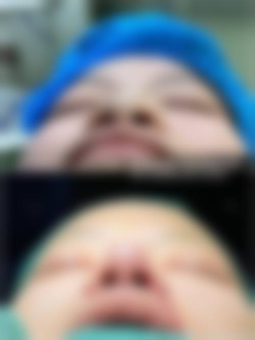 五、洛阳莱尔美医疗美容诊所收费价格表