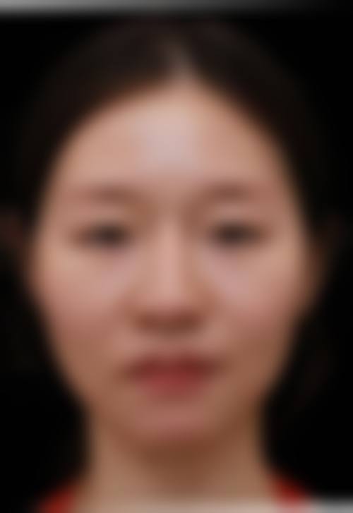 五、长沙县伊百丽整形医院收费价格表