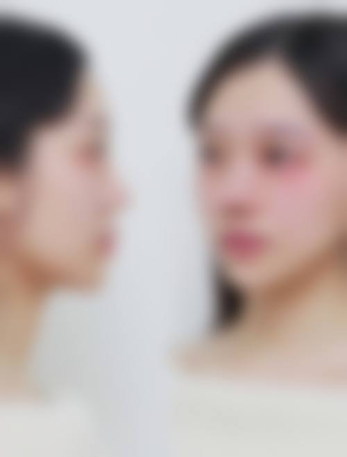 五、新余安贝拉整形医院收费价格表