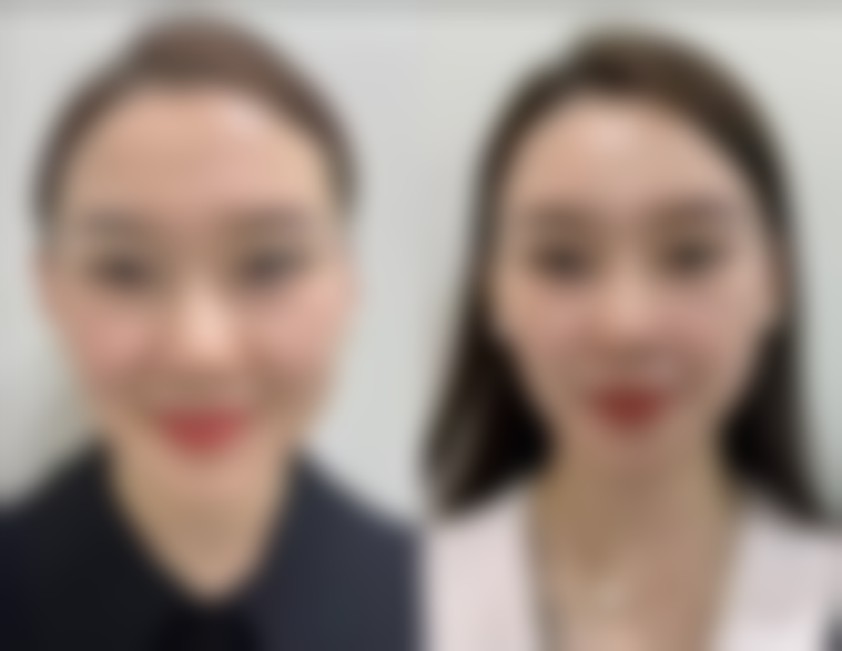 除化妆外的其他术后注意事项