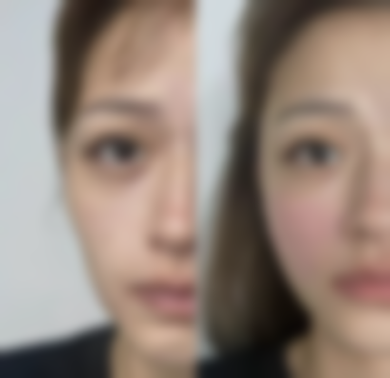 修复过程中的注意事项