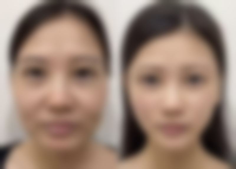 护肤保养：日常呵护，锦上添花