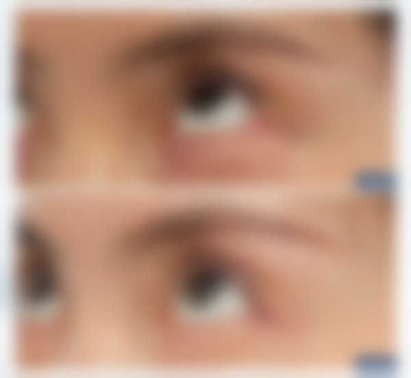 八、上海爱尚丽格医疗美容门诊部怎么预约？