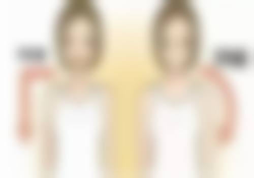 脂肪堆积型胳膊胖与抽脂