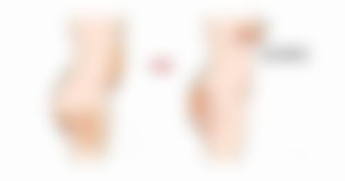 我45岁了有没有必要打瘦脸针？重视身体健康因素