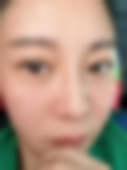 五、锡林郭勒盟颖美整形医院收费价格表