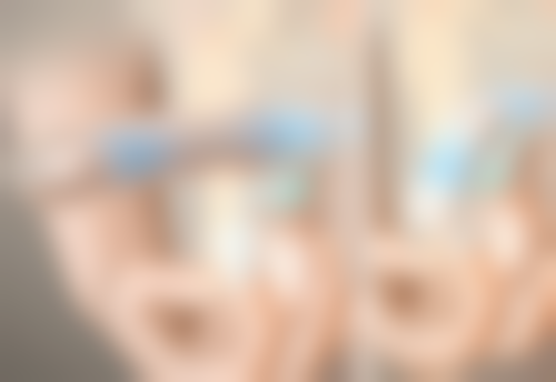 头发种植后还脱发吗？答案并非绝对，受多种因素影响，术后护理也至关重要！ 