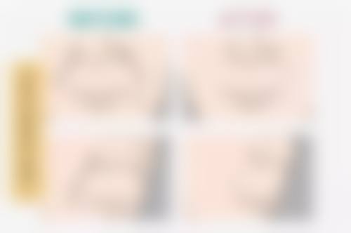 五、广州天姿医学美容郑铁南医生技术怎么样？