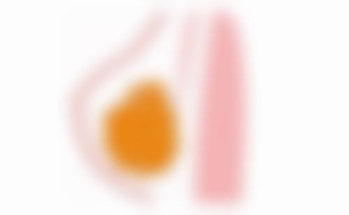 咀嚼无力：美食都变得索然无味