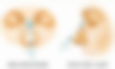 能治胸前疤痕疙瘩吗？答案是肯定的！多种治疗方法助您改善，护理要点也别错过！ 