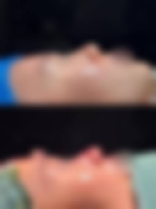 六、成都润美玉之光医疗美容口碑如何？