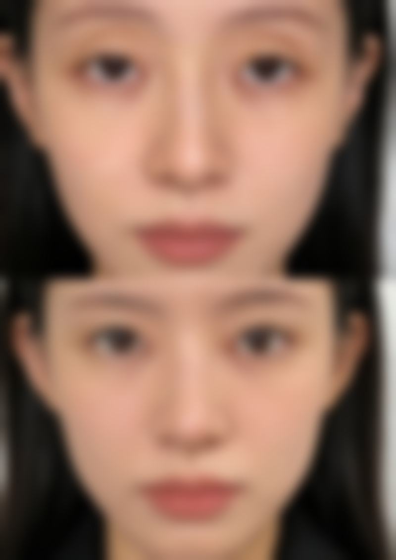 六、广州天姿医学美容郑铁南医生口碑评价及真人实例反馈