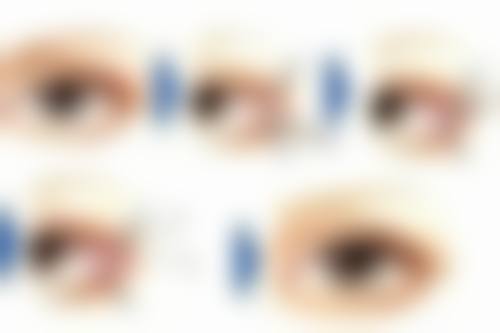 腿部吸脂一次吸多少？受体型、皮肤弹性等因素影响，一般单次不超3000ml才安全！ 