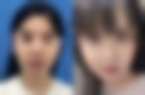 五、广州天姿医学美容郑铁南医生技术怎么样？