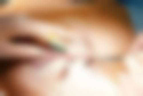 二、西宁陈丽医疗美容毛庆义医生擅长项目