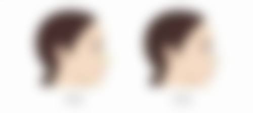 六、成都润美玉之光代忠洪医生口碑评价及真人实例反馈