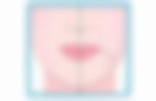 五、成都润美玉之光孙先医生技术怎么样?