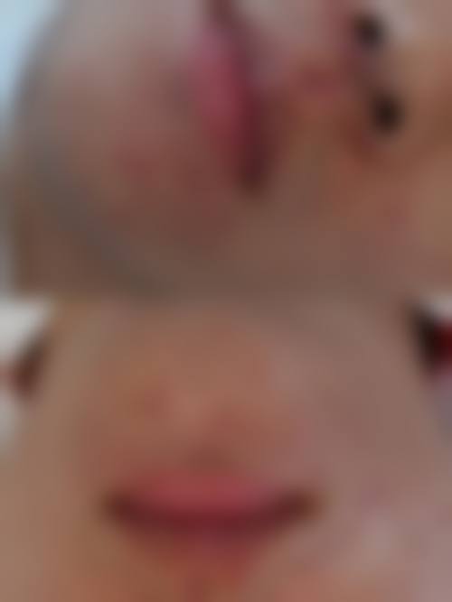 四、北京和颜一美公翠整形医院特色项目